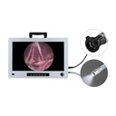 Monitor endoscopia 22", Full HD con camera CCD integrata e fonte di luce