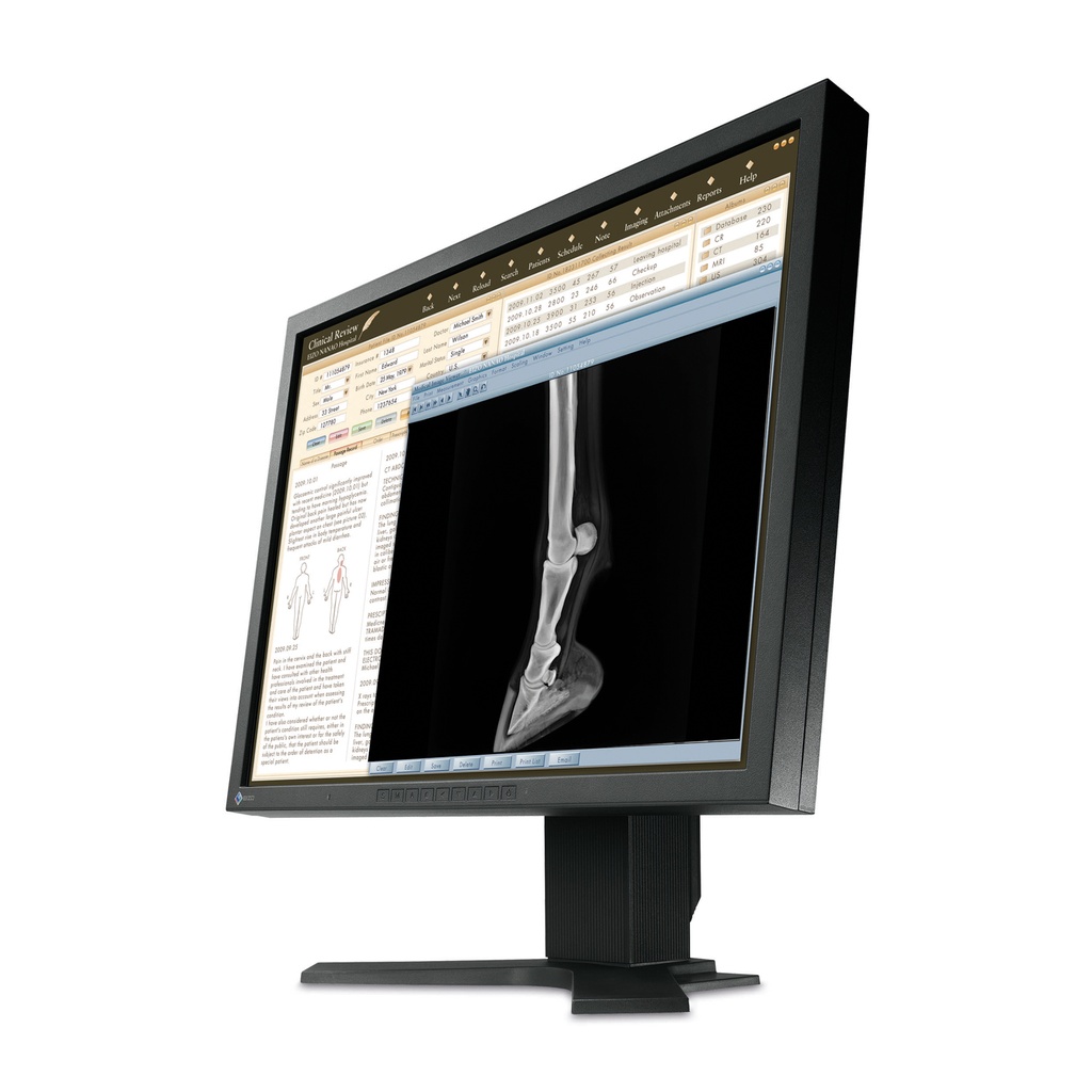 EIZO LCD 23" Betrachtungsmonitor - 16:9-Widescreen-Format und Full HD-Auflösung