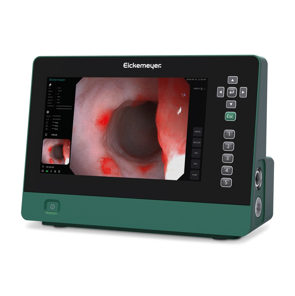 Sistema endoscopico EickView 5 in 1